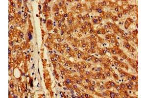 Immunohistochemistry of paraffin-embedded human liver tissue using ABIN7142170 at dilution of 1:100 (OAS1 抗体  (AA 296-395))