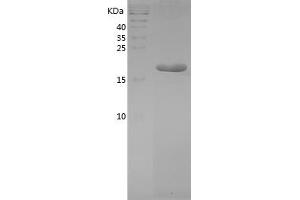 Western Blotting (WB) image for Interleukin 1, beta (IL1B) (AA 115-266) protein (His tag) (ABIN7123529) (IL-1 beta Protein (AA 115-266) (His tag))