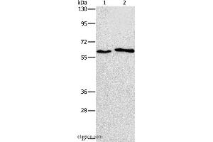 Western blot analysis of A172 and A549 cell, using CHRNA2 Polyclonal Antibody at dilution of 1:950 (CHRNA2 抗体)