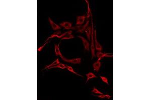 ABIN6275770 staining HepG2 by IF/ICC. (IL13RA2 抗体  (C-Term))