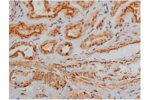 Immunohistochemistry (IHC) image for anti-cAMP Responsive Element Binding Protein 1 (CREB1) (pSer133) antibody (ABIN6256130)