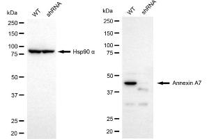 Western blotting analysis using Annexin A7 antibody (ABIN7797626). (Recombinant Annexin VII 抗体)