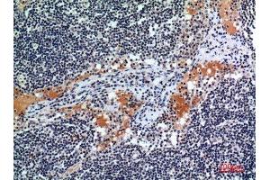 Immunohistochemistry (IHC) analysis of paraffin-embedded Human Lymph, antibody was diluted at 1:100.