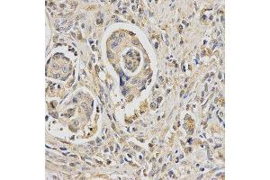 Immunohistochemistry (IHC) image for anti-HUS1 Checkpoint Homolog (S. Pombe) (HUS1) antibody (ABIN1876595) (HUS1 抗体)