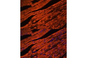 Immunofluorescence analysis of mouse heart cells using LDB3 antibody (ABIN6128179, ABIN6143125, ABIN6143126 and ABIN6223347) at dilution of 1:100. (LIM Domain Binding 3 Protein 抗体  (AA 1-283))