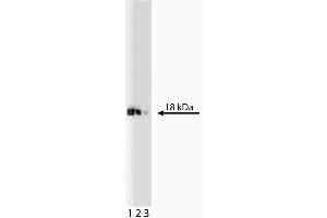 Western blot analysis of eIF-5a on a Jurkat lysate. (EIF5A 抗体  (AA 58-154))
