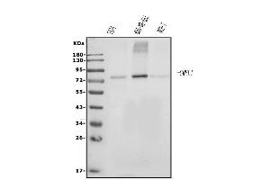 Western blot analysis of Grainyhead-like protein 1/GRHL1 using anti-Grainyhead-like protein 1/GRHL1 antibody (ABIN7599498).