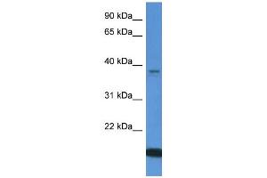 Western Blotting (WB) image for anti-WD Repeat Domain 54 (WDR54) (C-Term) antibody (ABIN2774289) (WDR54 抗体  (C-Term))
