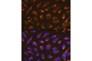 Immunofluorescence analysis of U-2 OS cells using Smac/Diablo Rabbit mAb (ABIN7270177) at dilution of 1:100 (40x lens). (DIABLO 抗体)