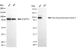 Western blotting analysis using activating transcription factor 6 antibody (ABIN7797486).