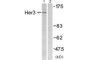 Western blot analysis of extracts from COLO205 cells, using HER3 antibody. (ERBB3 抗体  (N-Term))