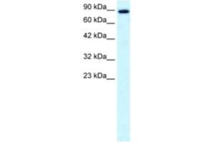 Western Blotting (WB) image for anti-Kinesin Family Member 21A (KIF21A) antibody (ABIN2460843) (KIF21A 抗体)
