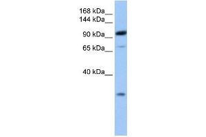 AP2B1 antibody used at 1 ug/ml to detect target protein. (AP2B1 抗体  (C-Term))