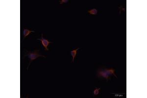 Immunofluorescence analysis of U-251 MG cells using GFAP antibody (ABIN5970067). (GFAP 抗体)