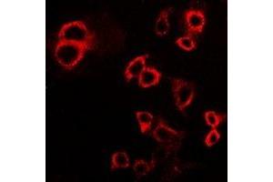 Immunofluorescent analysis of IFNGR1 staining in HepG2 cells. (IFNGR1 抗体  (C-Term))
