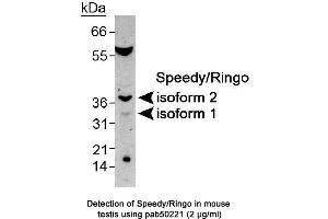 Speedy Homolog B (Xenopus Laevis) (SPDYB) (AA 200-286), (both Isoforms), (C-Term) 抗体
