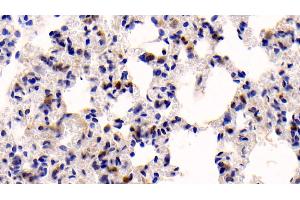 Detection of CASP3 in Rat Lung Tissue using Polyclonal Antibody to Caspase 3 (CASP3)