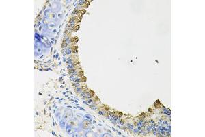 Immunohistochemistry of paraffin-embedded mouse lung using AIF1 antibody (ABIN5970719) at dilution of 1/100 (40x lens). (Iba1 抗体)