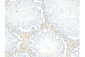 ABIN6263171 and ABIN6278338 at 1/100 staining Rat testis tissue by IHC-P. (MCRS1 抗体  (N-Term))