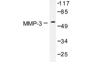 Image no. 1 for anti-Matrix Metallopeptidase 3 (Stromelysin 1, Progelatinase) (MMP3) antibody (ABIN265531) (MMP3 抗体)