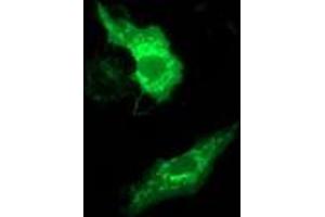Anti-MMAB mouse monoclonal antibody (ABIN2454035) immunofluorescent staining of COS7 cells transiently transfected by pCMV6-ENTRY MMAB (RC204290). (MMAB 抗体)