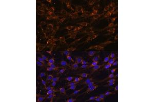 Immunofluorescence analysis of C6 cells using PREPL Polyclonal Antibody (ABIN7269561) at dilution of 1:100 (40x lens). (PREPL 抗体  (AA 578-727))