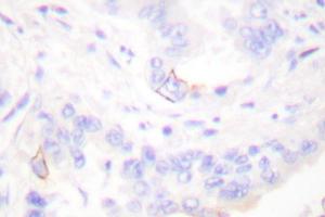 Image no. 1 for anti-V-Crk Sarcoma Virus CT10 Oncogene Homolog (Avian) (CRK) antibody (ABIN265373) (Crk 抗体)