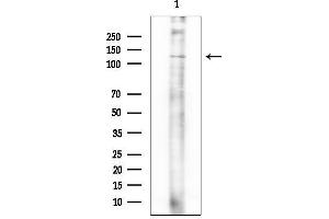 anti-Mitogen-Activated Protein Kinase Kinase Kinase 11 (MAP3K11) (Internal Region) antibody