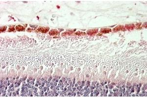 (ABIN571175) (5 μg/mL) staining of paraffin embedded Human Retina. (RDH5 抗体  (AA 19-31))