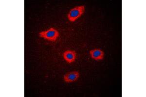 Immunofluorescent analysis of Mammaglobin A staining in MCF7 cells. (Mammaglobin A 抗体  (Center))