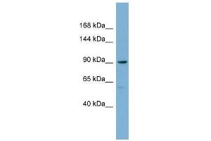 Western Blot showing E2F8 antibody used at a concentration of 1-2 ug/ml to detect its target protein. (E2F8 抗体  (Middle Region))