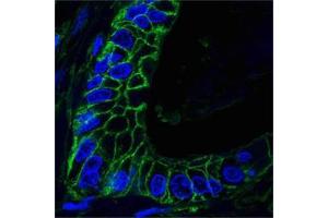 Confocal analysis of paraffin-embedded human lung cancer tissues using CD44 antibody (green), showing membrane localization. (CD44 抗体)