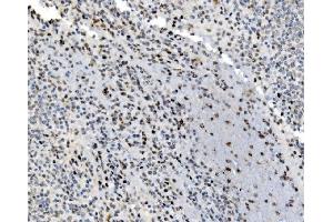 IHC analysis of JUNB using anti-JUNB antibody (ABIN7603223). (JunB 抗体  (N-Term))