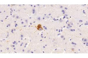 Immunohistochemistry (IHC) image for anti-Nitric Oxide Synthase 1, Neuronal (NOS1) (AA 53-247) antibody (ABIN7437716)