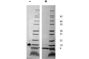 SDS-PAGE of Mouse Stromal Cell-Derived Factor-1 alpha (CXCL12) Recombinant Protein SDS-PAGE of Mouse Stromal Cell-Derived Factor-1 alpha (CXCL12) Recombinant Protein.
