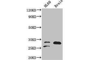 Western Blot Positive WB detected in: HL60 whole cell lysate, Mouse brain tissue All lanes: TPI1 antibody at 2 μg/mL Secondary Goat polyclonal to rabbit IgG at 1/50000 dilution Predicted band size: 31, 27, 18 kDa Observed band size: 31, 27 kDa (TPI1 抗体  (AA 169-228))