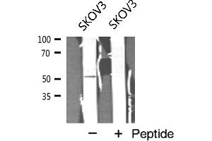 Western blot analysis of Cyclin A1 expression in SKOV3 cell extract (Cyclin A1 抗体)