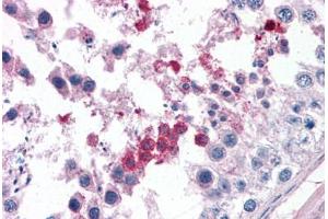 Human Testis: Formalin-Fixed, Paraffin-Embedded (FFPE) (Septin 3 抗体  (AA 15-26))