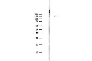 Western blot analysis of lysates from PC12 cells(LPS,4h treatment), using Phospho-VEGFR2 (Tyr1214) Antibody at 1/1000 dilution.
