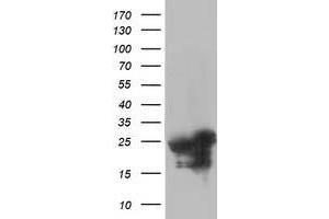 Western Blotting (WB) image for anti-Adenylate Kinase 4 (AK4) antibody (ABIN1496529) (AK4 抗体)