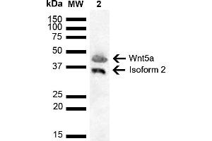 Western blot analysis of Human Cervical cancer cell line (HeLa) lysate showing detection of ~42. (WNT5A 抗体  (AA 200-300) (FITC))