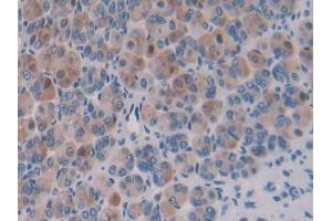 DAB staining on IHC-P; Samples: Mouse Stomach Tissue (Importin 8 抗体  (AA 417-622))