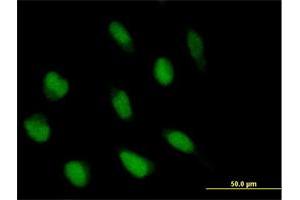 Immunofluorescence of purified MaxPab antibody to ABI2 on HeLa cell. (ABI2 抗体  (AA 1-475))