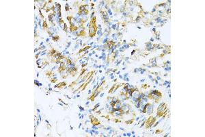 Immunohistochemistry of paraffin-embedded mouse lung using V antibody (ABIN6130774, ABIN6150046, ABIN6150047 and ABIN6224821) at dilution of 1:100 (40x lens). (VAMP1 抗体  (AA 1-96))