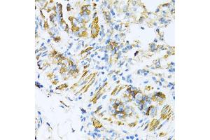 Immunohistochemistry of paraffin-embedded mouse lung using V antibody (ABIN6130774, ABIN6150046, ABIN6150047 and ABIN6224821) at dilution of 1:100 (40x lens).