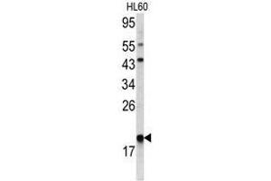 Image no. 1 for anti-Actin Related Protein 2/3 Complex, Subunit 3, 21kDa (ARPC3) (C-Term) antibody (ABIN452763) (ARPC3 抗体  (C-Term))