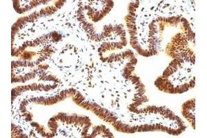 Image no. 3 for anti-Small Ubiquitin Related Modifier Protein 1 (SUMO1) antibody (ABIN6186913) (SUMO1 抗体)