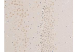 ABIN6267268 at 1/100 staining mouse brain tissue sections by IHC-P. (EGFR 抗体  (pSer1026))