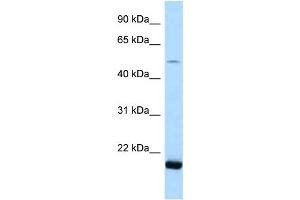 WB Suggested Anti-SARS2 Antibody Titration: 1. (SARS2 抗体  (N-Term))