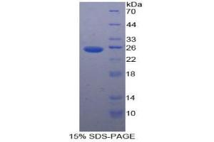 SDS-PAGE analysis of Human PK Protein. (PKLR 蛋白)